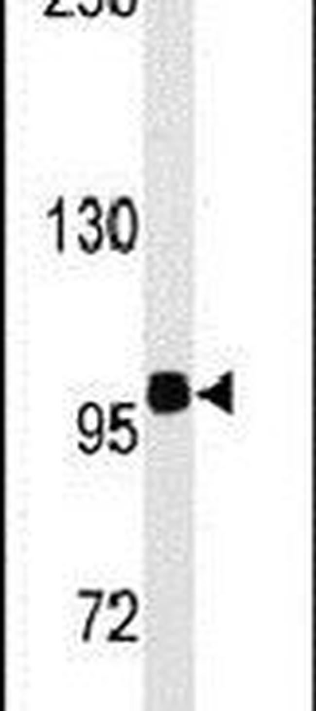 HIPK2 Antibody in Western Blot (WB)