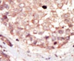HIPK3 Antibody in Immunohistochemistry (IHC)