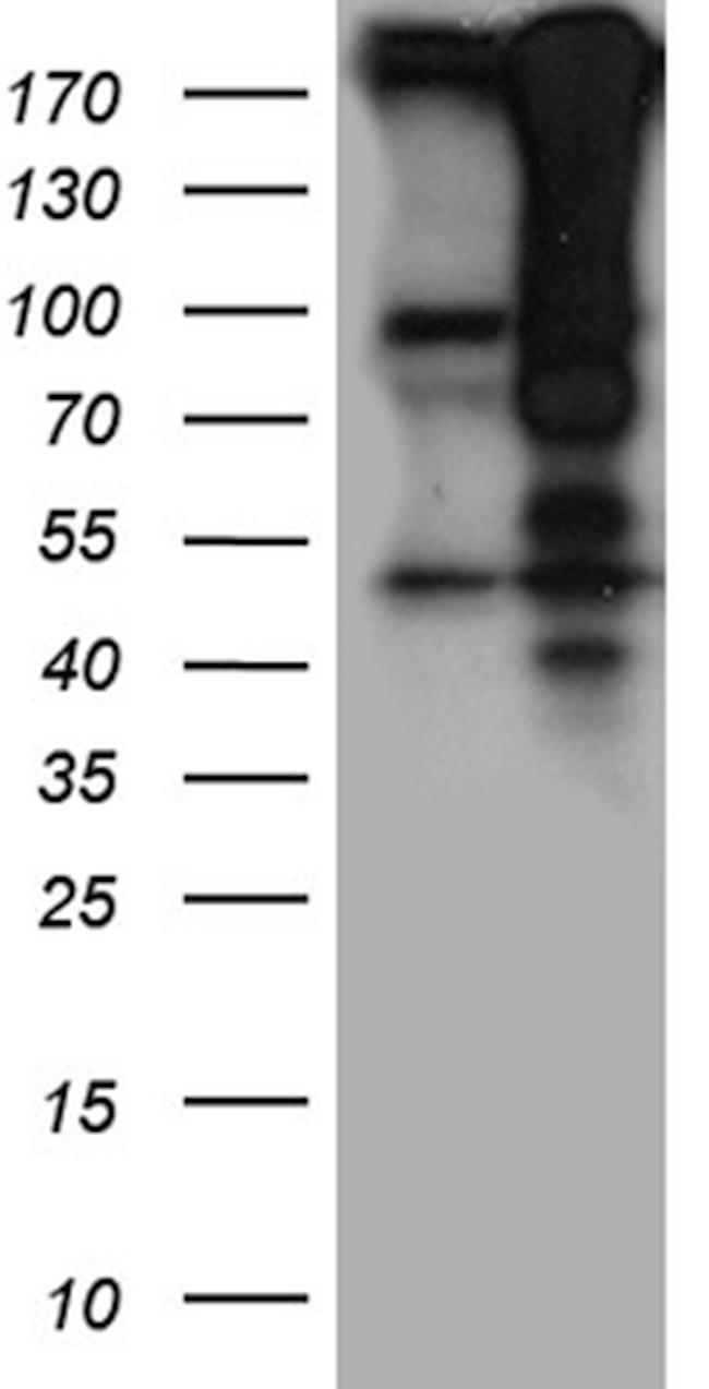 HIRA Antibody in Western Blot (WB)