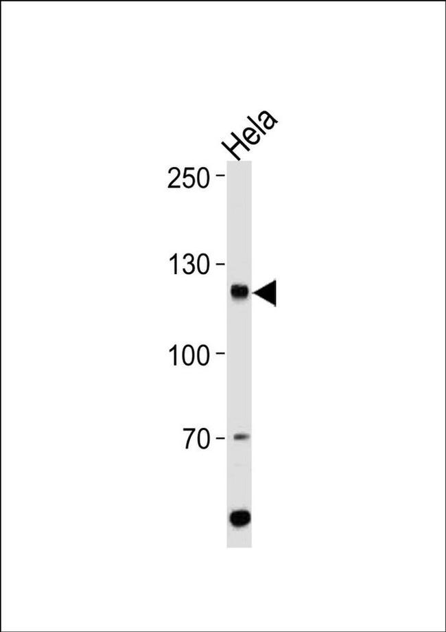 HIRA Antibody in Western Blot (WB)