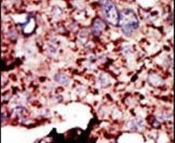 HK1 Antibody in Immunohistochemistry (IHC)