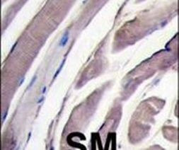 HK2 Antibody in Immunohistochemistry (IHC)