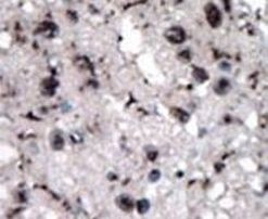 HK2 Antibody in Immunohistochemistry (IHC)