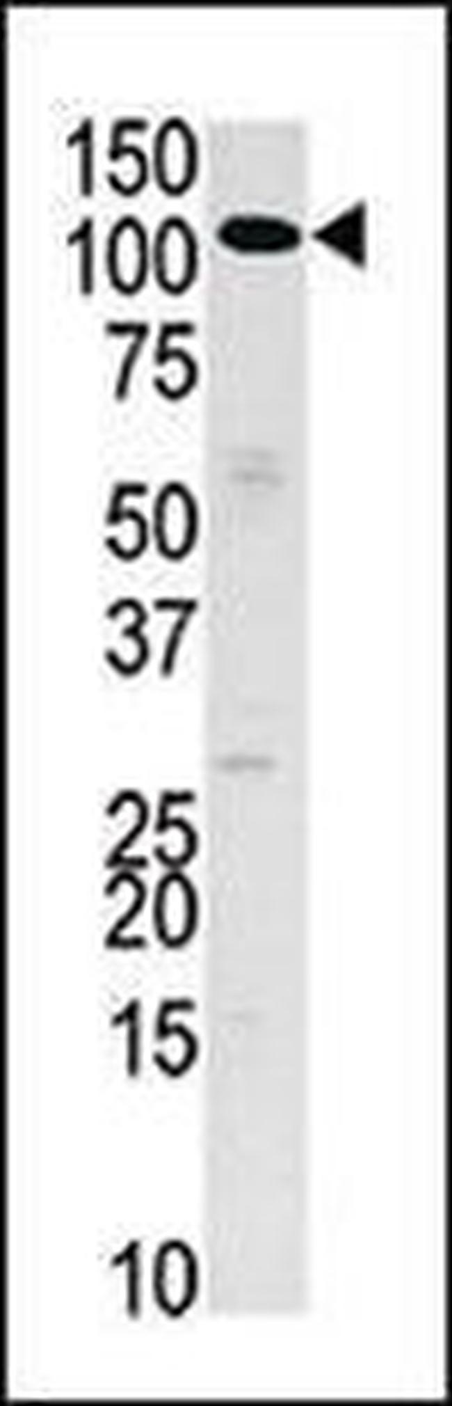 HK3 Antibody in Western Blot (WB)
