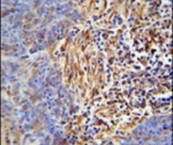 HLA-DRB5 Antibody in Immunohistochemistry (IHC)