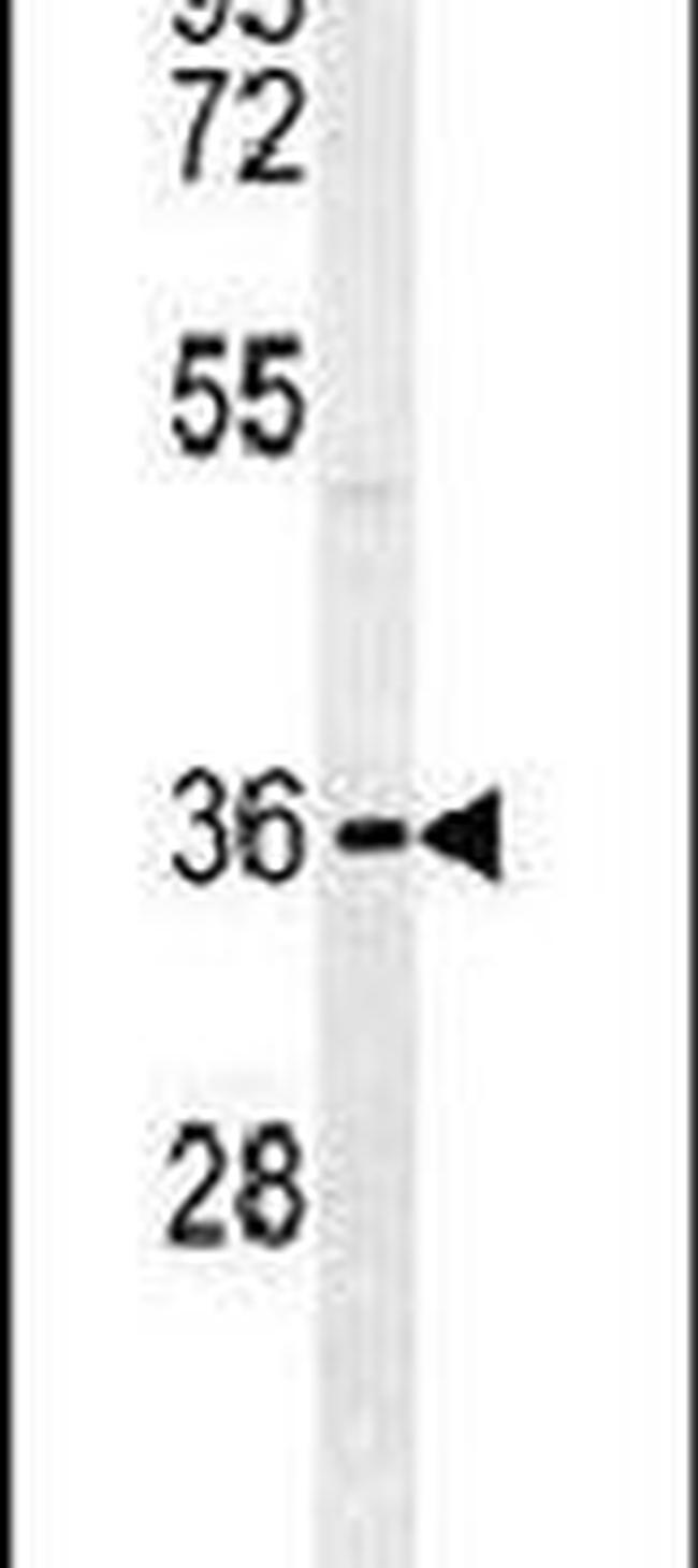 HLA-F Antibody in Western Blot (WB)