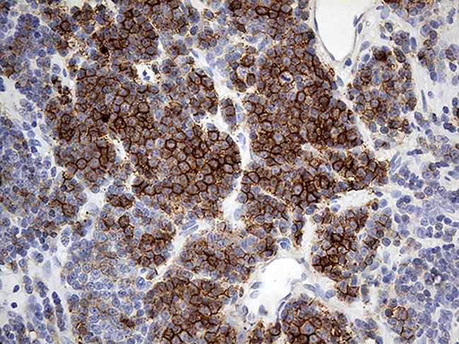HLA Antibody in Immunohistochemistry (Paraffin) (IHC (P))