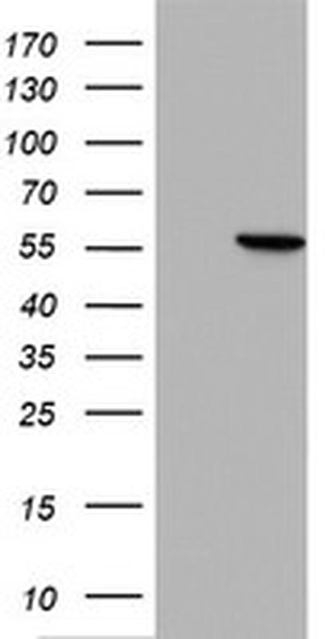 HMBS Antibody in Western Blot (WB)
