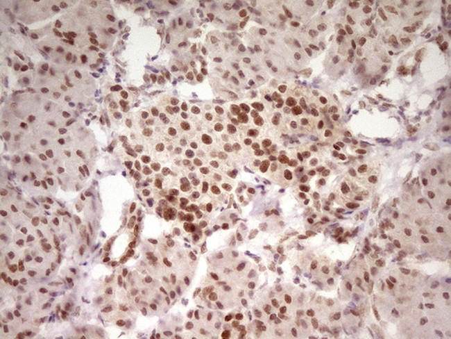 HMG20A Antibody in Immunohistochemistry (Paraffin) (IHC (P))