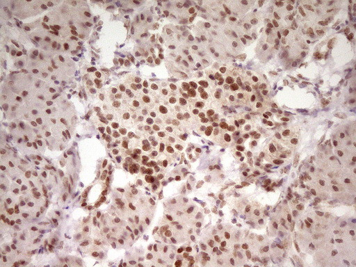 HMG20A Antibody in Immunohistochemistry (Paraffin) (IHC (P))