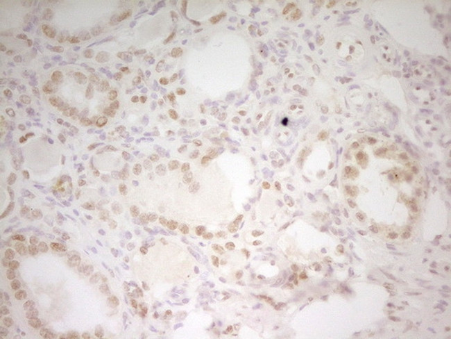 HMG20A Antibody in Immunohistochemistry (Paraffin) (IHC (P))