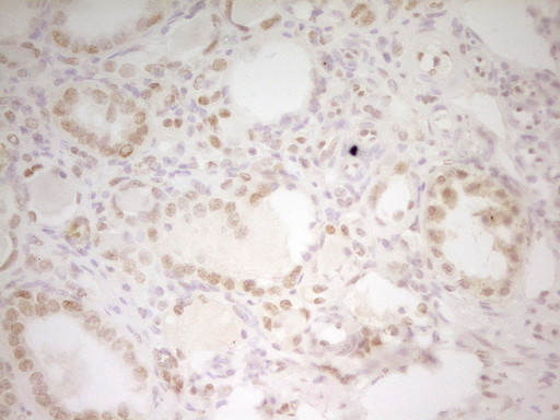 HMG20A Antibody in Immunohistochemistry (Paraffin) (IHC (P))