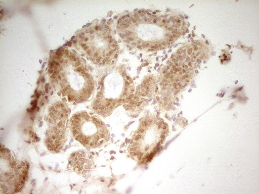HMG20A Antibody in Immunohistochemistry (Paraffin) (IHC (P))