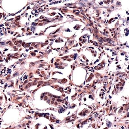 HMGA2 Antibody in Immunohistochemistry (IHC)