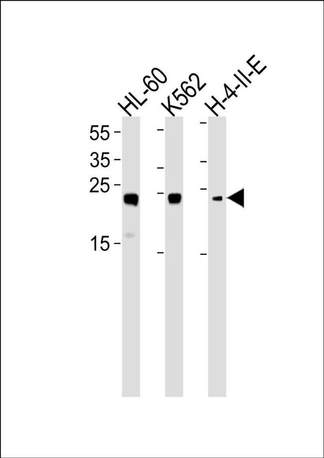 HMGB2 Antibody in Western Blot (WB)
