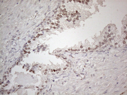 HMGB4 Antibody in Immunohistochemistry (Paraffin) (IHC (P))