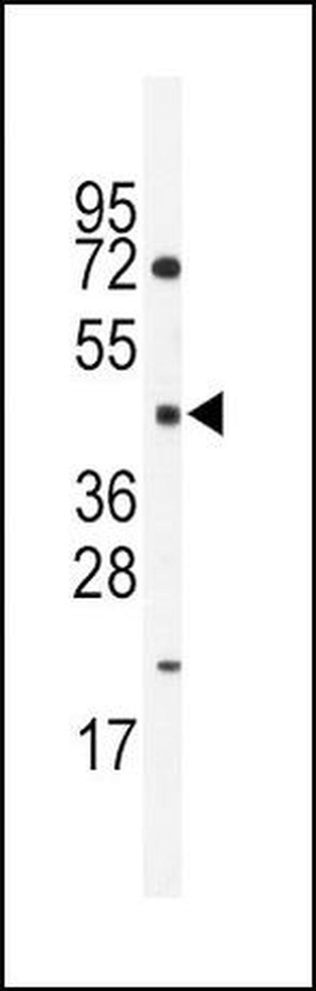 HNF4G Antibody in Western Blot (WB)