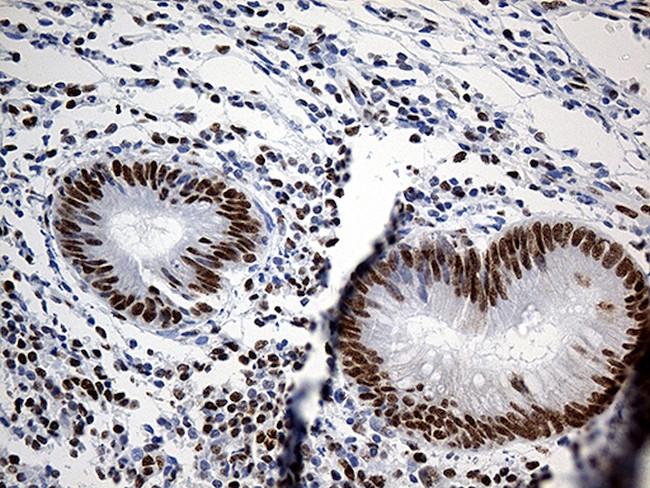 HNRNPH1 Antibody in Immunohistochemistry (Paraffin) (IHC (P))