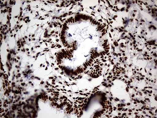 HNRNPH1 Antibody in Immunohistochemistry (Paraffin) (IHC (P))