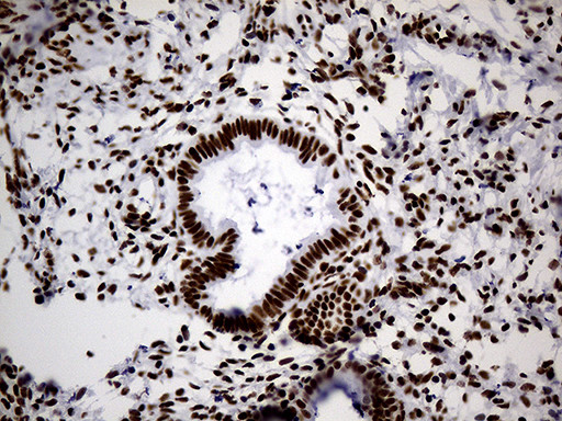 HNRNPH1 Antibody in Immunohistochemistry (Paraffin) (IHC (P))