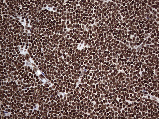 HNRNPL Antibody in Immunohistochemistry (Paraffin) (IHC (P))