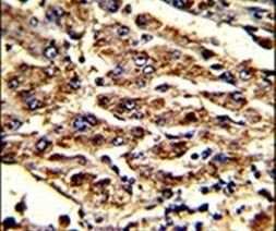 HOMER1 Antibody in Immunohistochemistry (IHC)