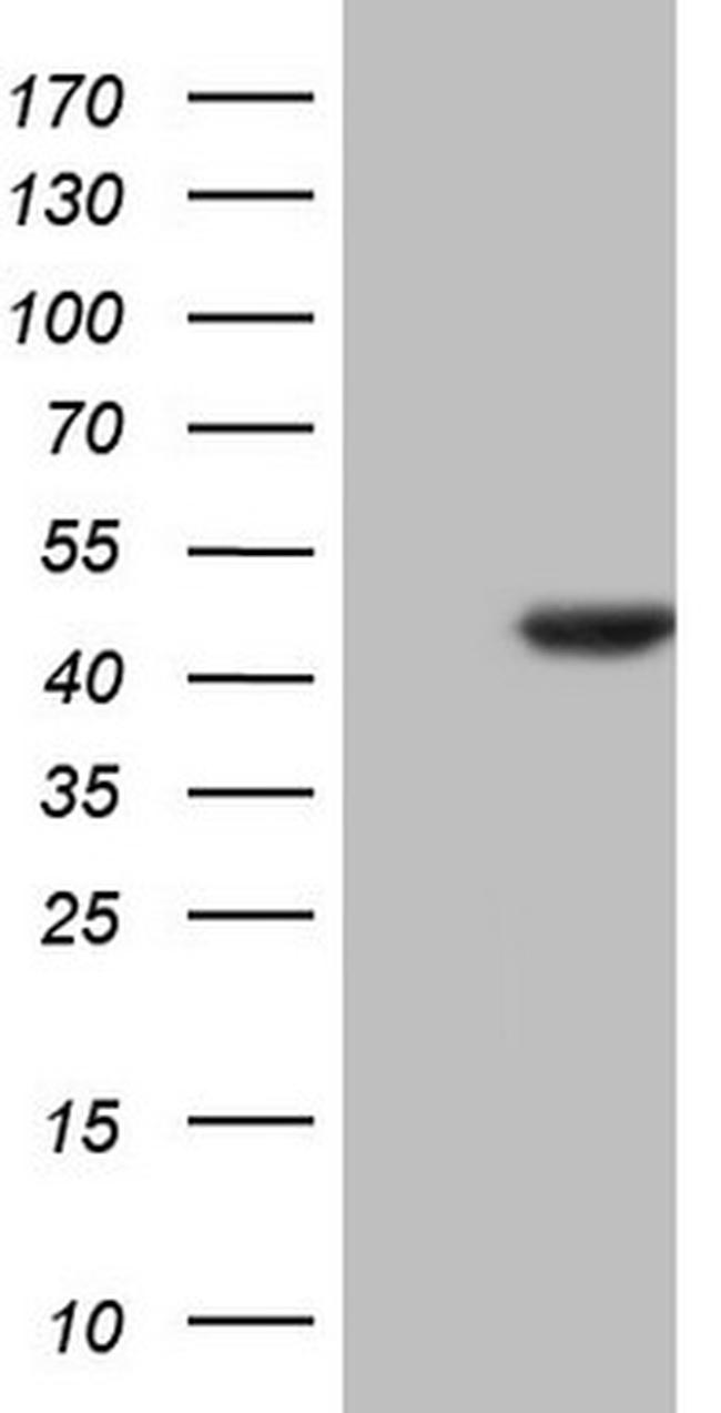 HOMER2 Antibody in Western Blot (WB)