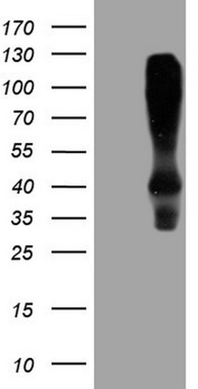 HOMER2 Antibody in Western Blot (WB)