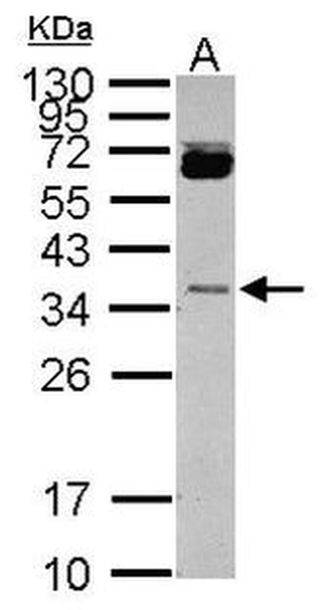 HORMAD1 Antibody in Western Blot (WB)