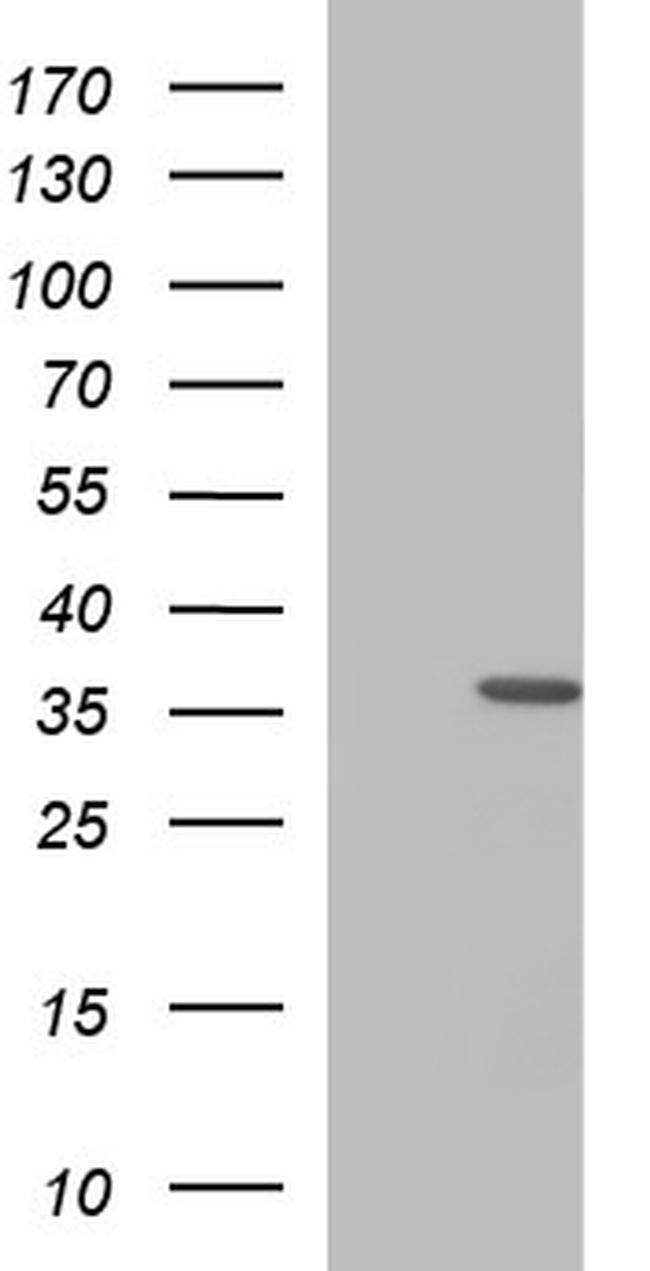 HORMAD2 Antibody in Western Blot (WB)