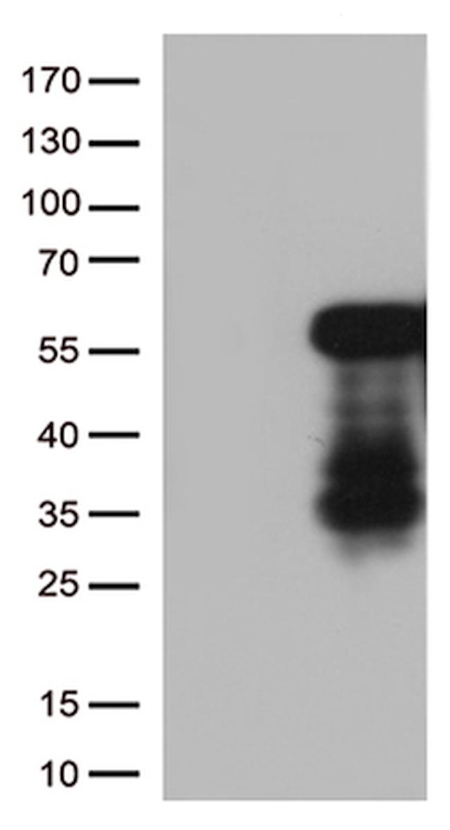 HOXA2 Antibody in Western Blot (WB)