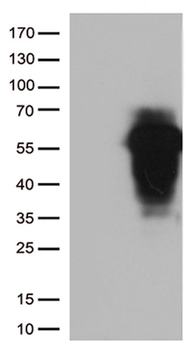 HOXA2 Antibody in Western Blot (WB)