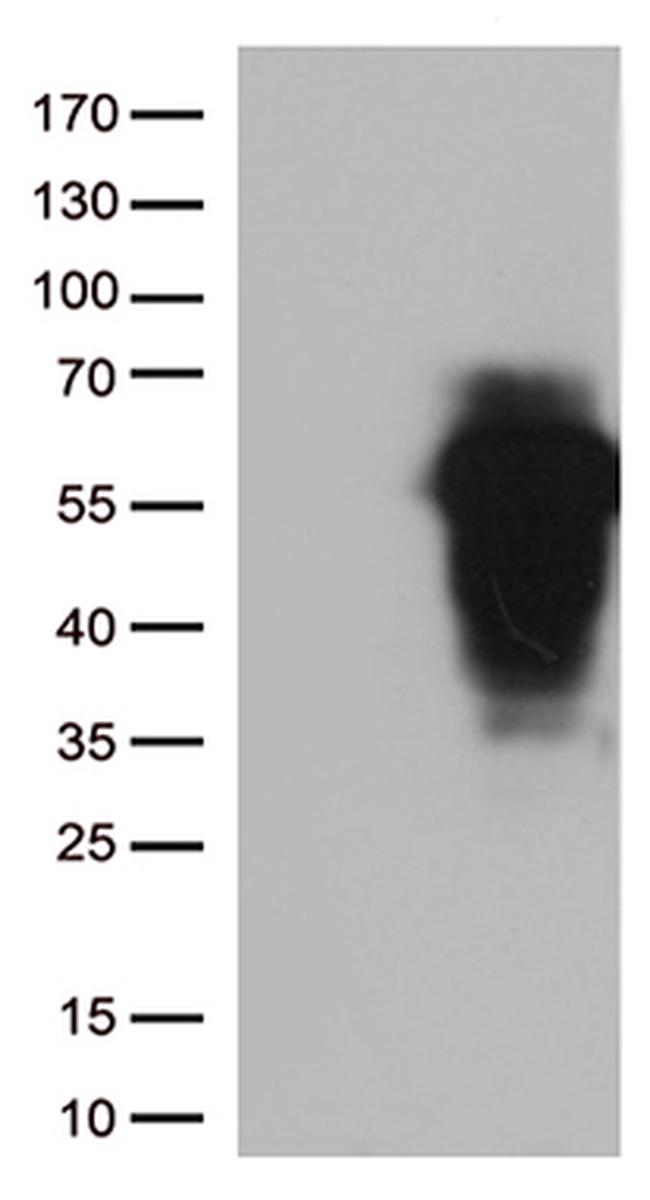HOXA2 Antibody in Western Blot (WB)