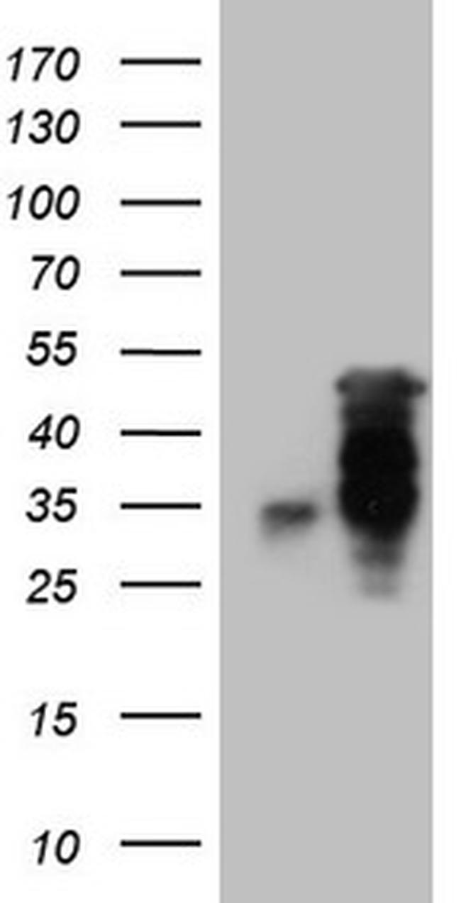 HOXC10 Antibody in Western Blot (WB)