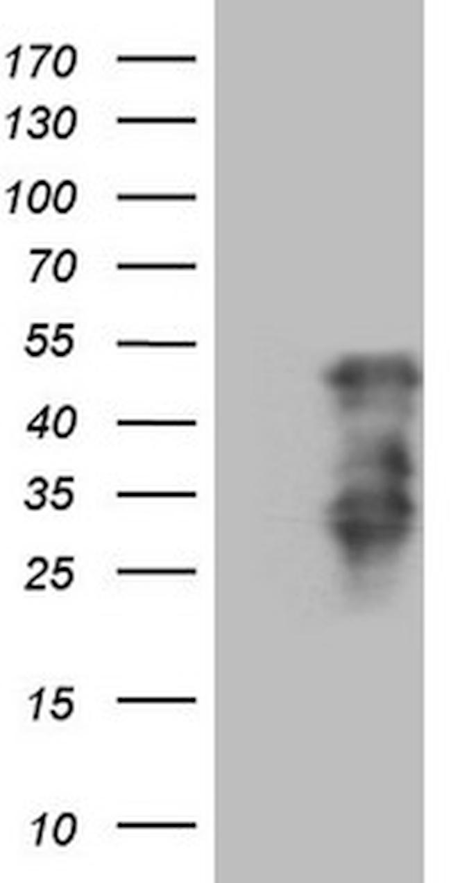 HOXC10 Antibody in Western Blot (WB)