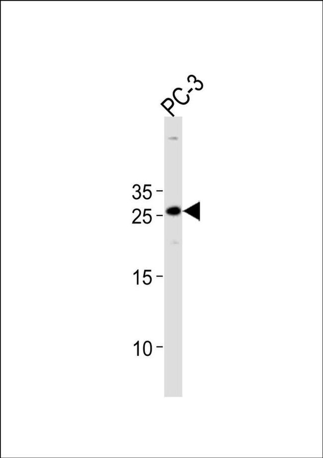 HOXC6 Antibody in Western Blot (WB)