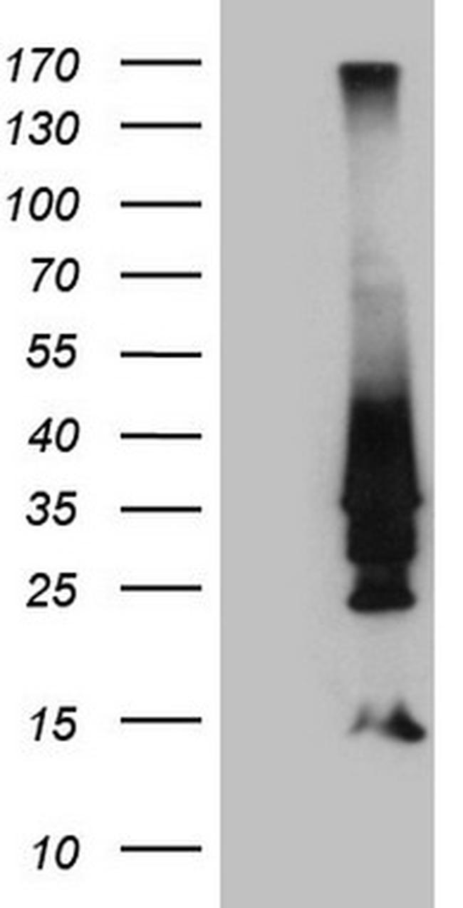 HOXD4 Antibody in Western Blot (WB)