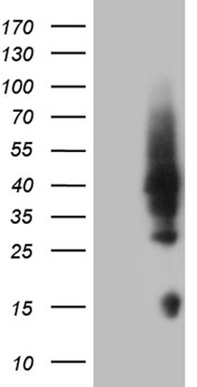 HOXD4 Antibody in Western Blot (WB)