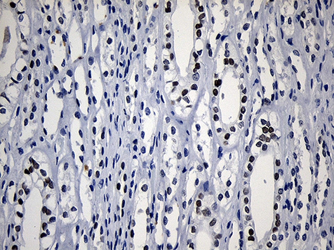 HOXD8 Antibody in Immunohistochemistry (Paraffin) (IHC (P))