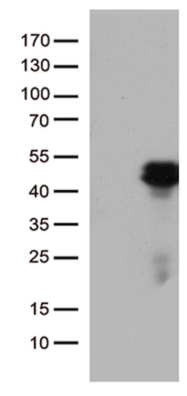 HOXD8 Antibody in Western Blot (WB)