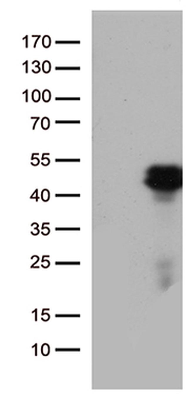 HOXD8 Antibody in Western Blot (WB)