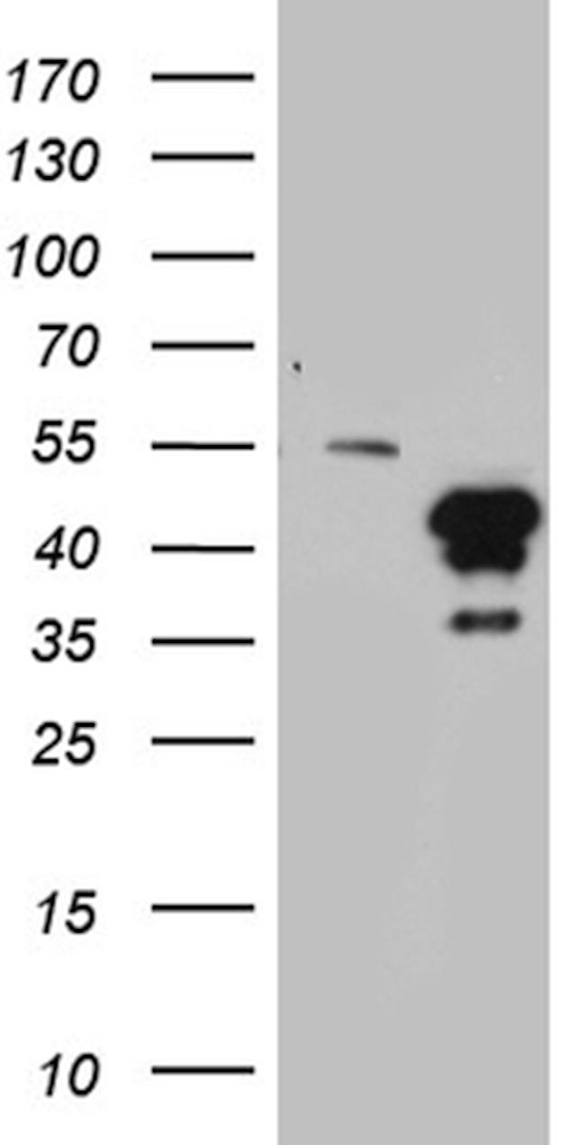 HOXD9 Antibody in Western Blot (WB)