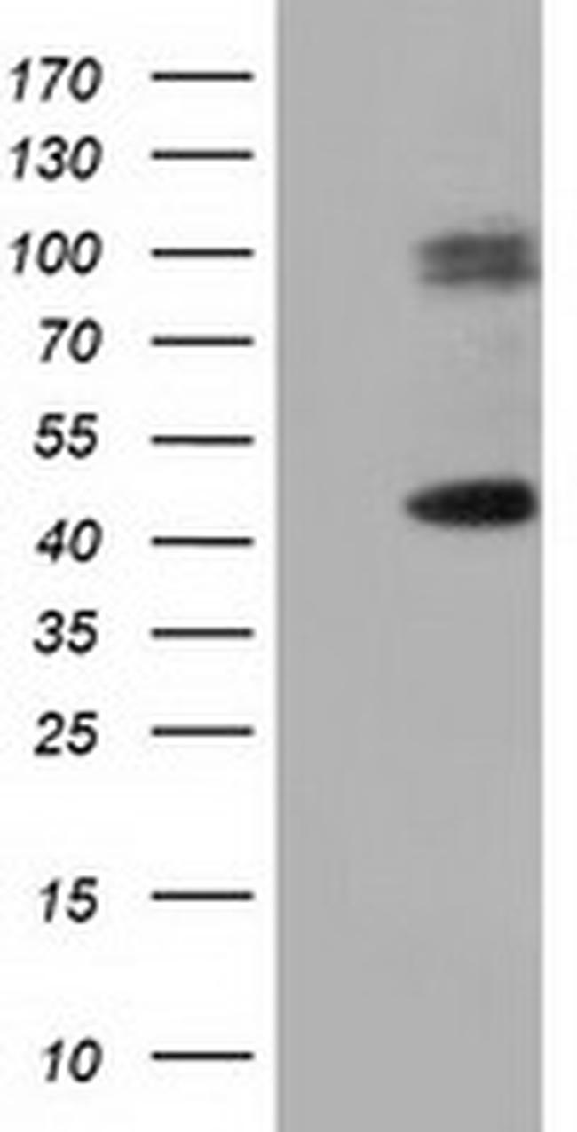 HP Antibody in Western Blot (WB)