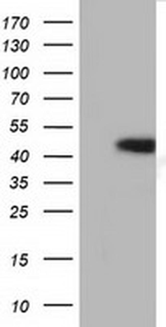 HP Antibody in Western Blot (WB)