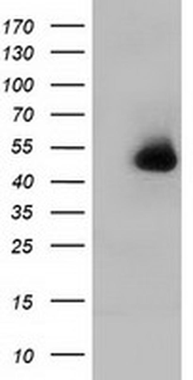 HP Antibody in Western Blot (WB)