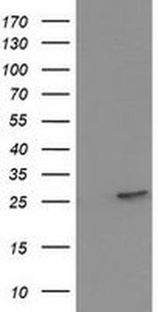 HPGD Antibody in Western Blot (WB)