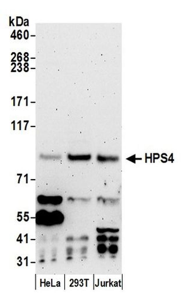 HPS4 Antibody in Western Blot (WB)