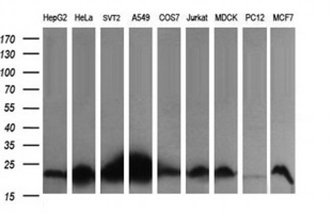 HRAS Antibody in Western Blot (WB)