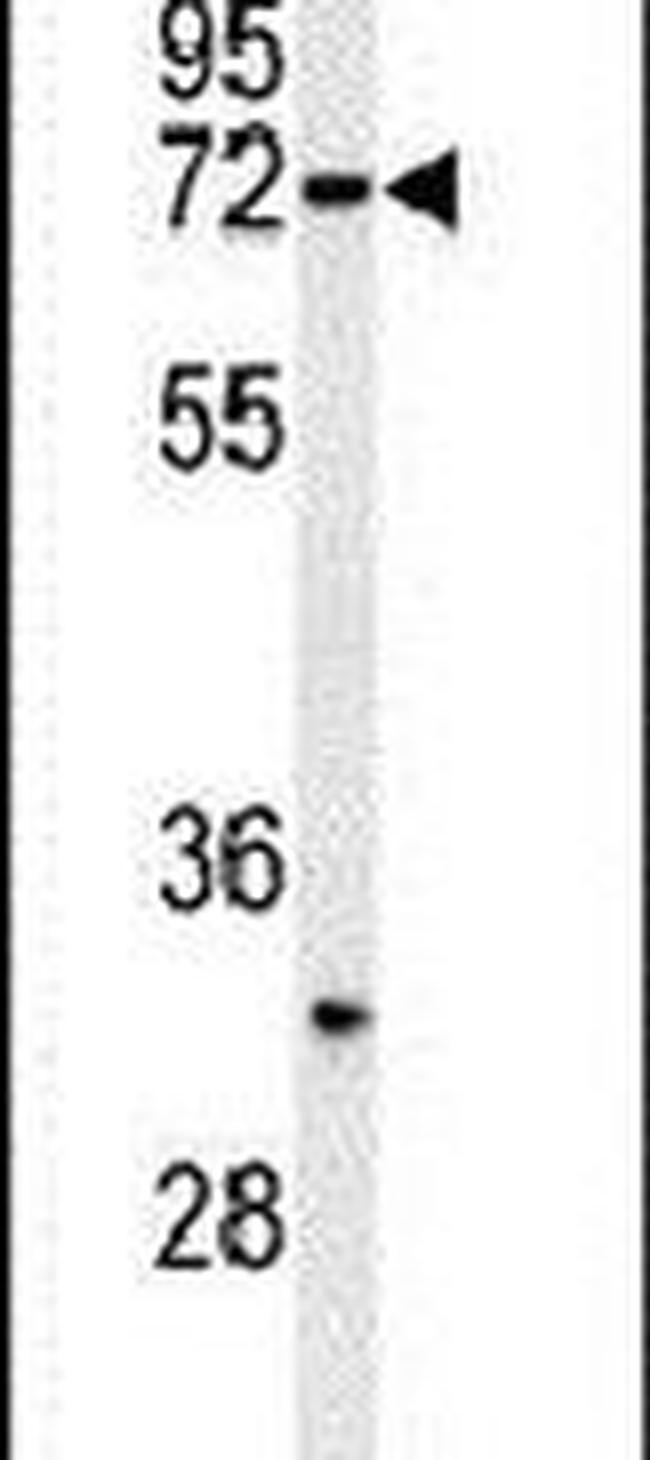 HRD1 Antibody in Western Blot (WB)