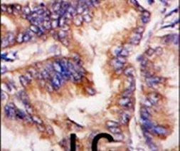 HRI Antibody in Immunohistochemistry (IHC)